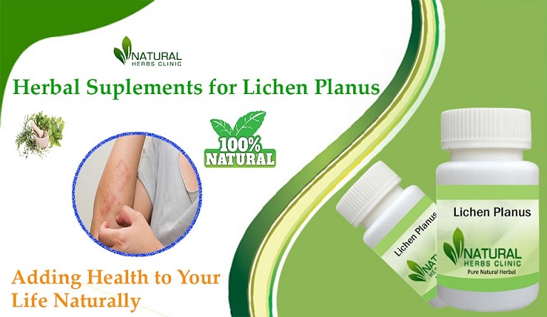 Lichen Planus Remedies That Work: Discover the Natural Healing Secr...